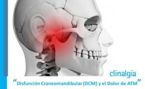 Disfunción Craneomandibular (DCM) y el Dolor de ATM