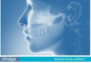 Dolor facial atípico