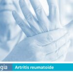 Artritis Reumatoide: Síntomas y Tratamiento