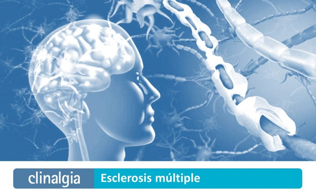 Esclerosis Múltiple: Síntomas y Tratamiento