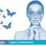 Lupus Eritematoso: Síntomas y Tratamiento