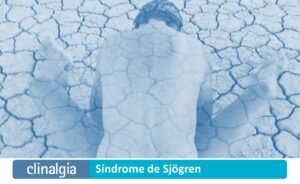 Síndrome de Sjögren: Síntomas y Tratamiento