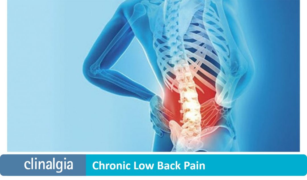 chronic-low-back-pain-cl-nica-del-dolor-murcia-y-granada