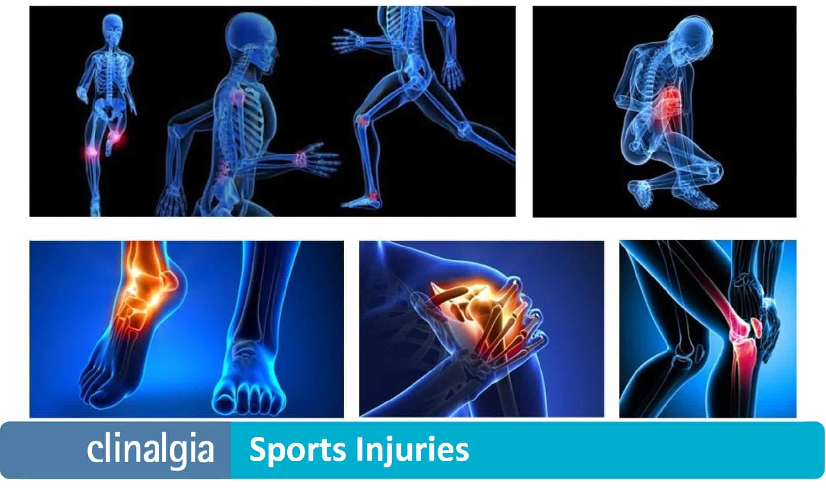Sports Injuries what they are, causes and type Clinalgia Sports Clinic image photo