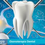 Ozonoterapia Dental